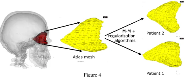 Figure 4Atlas mesh Patient 2Patient 1M-M + regularization algorithmsAtlas meshPatient 2Patient 1M-M + regularization algorithmsAtlas meshPatient 2Patient 1M-M + regularization algorithmsAtlas meshPatient 2Patient 1M-M + regularization algorithms