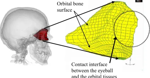 Fig. 2. Manual generation of the orbital mesh, (a) left : in the patient skull and (b) right: with a Orbital bone