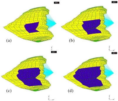 Fig. 4. The four osteotomies simulated to study the influence of the surface on the eyeball  backward displacement 