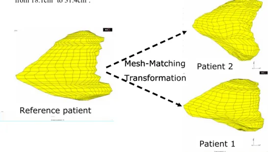 Fig. 5. Transformation with the Mesh-Matching of the reference patient mesh in order to auto- auto-matically generate the new patient meshes and to fit their morphologies