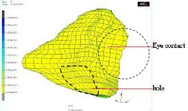 Fig. 3. 3D FE generic mesh: all elements are hexahedrons ; the simulated hole is located in the  ethmoid sinus region