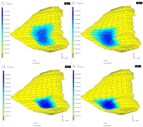 Fig. 4. Patient simulations with four different holes, from left to right: large holes at the front  of the orbit and at the back of the orbit (top), and medium holes at the front of the orbit and at  the back of the orbit (bottom)