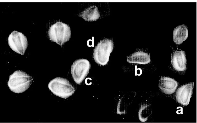 Figure 2 : Typologie radiographique des graines de genévrier thurifère.