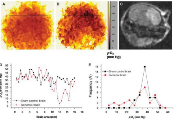 Figure  3-5  PO 2   distribution  in  ischemic  mouse  brain  recorded  by  EPR  2D  spectral-spatial 