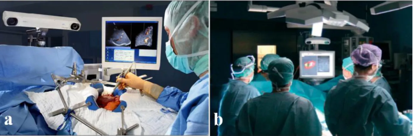 Figure 3.4: Application of OTS in the operating room: (a) Polaris localizer camera used to track a  surgical instrument in an image-guided liver resection procedure [46], (b) NDI Vicra, a passive 