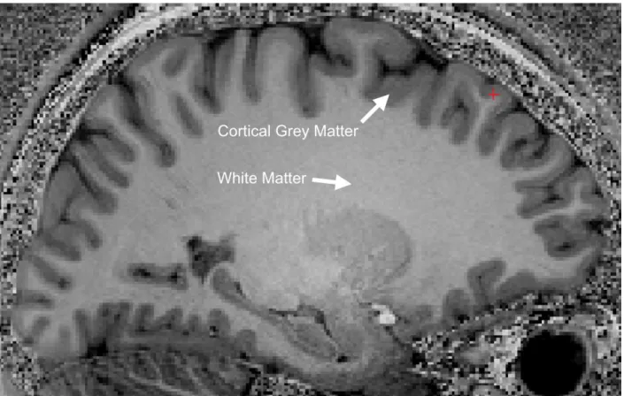 Figure 2-6, MRI T 1 -w image, sagittal view. The cortical grey matter (GM) is the outer (dark) layer  of the brain, while the inside white region is the white matter (WM)