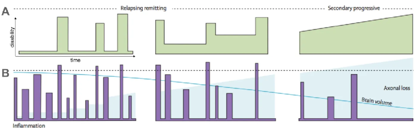 Figure  2-15,  adapted  from  (Compston  &amp;  Coles  2008) .  (A)  Example  of  the  progression  of  the  disability over time for RRMS and SPMS patients