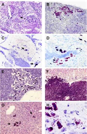 Table I. Mastocytosis in Bchm/Asp816Val Kit transgenic mice Age of mice