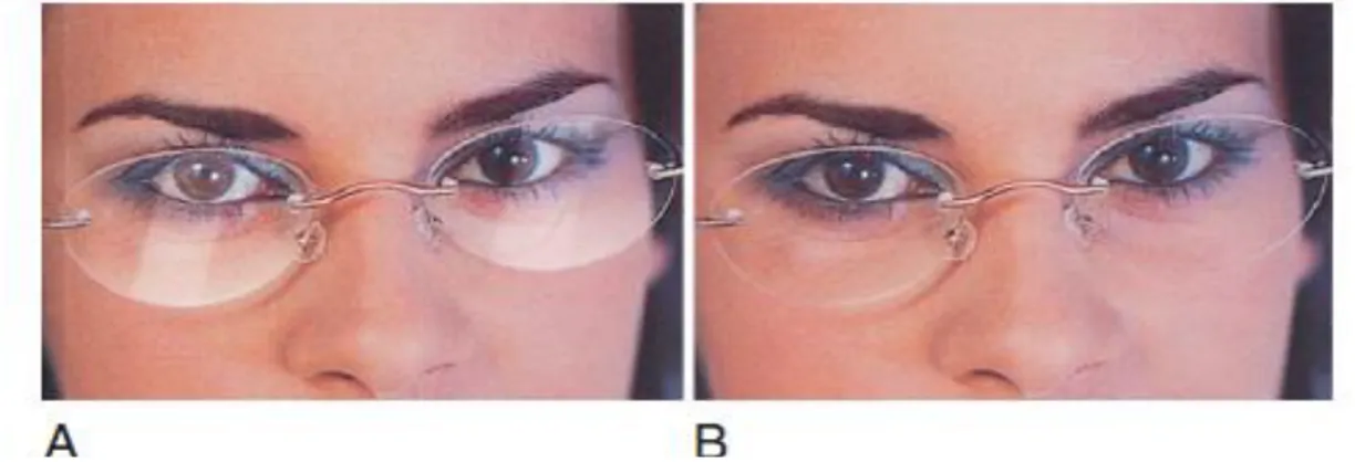 Figure 2. A Effet ―vitrine‖ d’un verre non traité antireflet ; B Revêtement antireflet enlève  l’effet «vitrine» sur les lentilles [16]