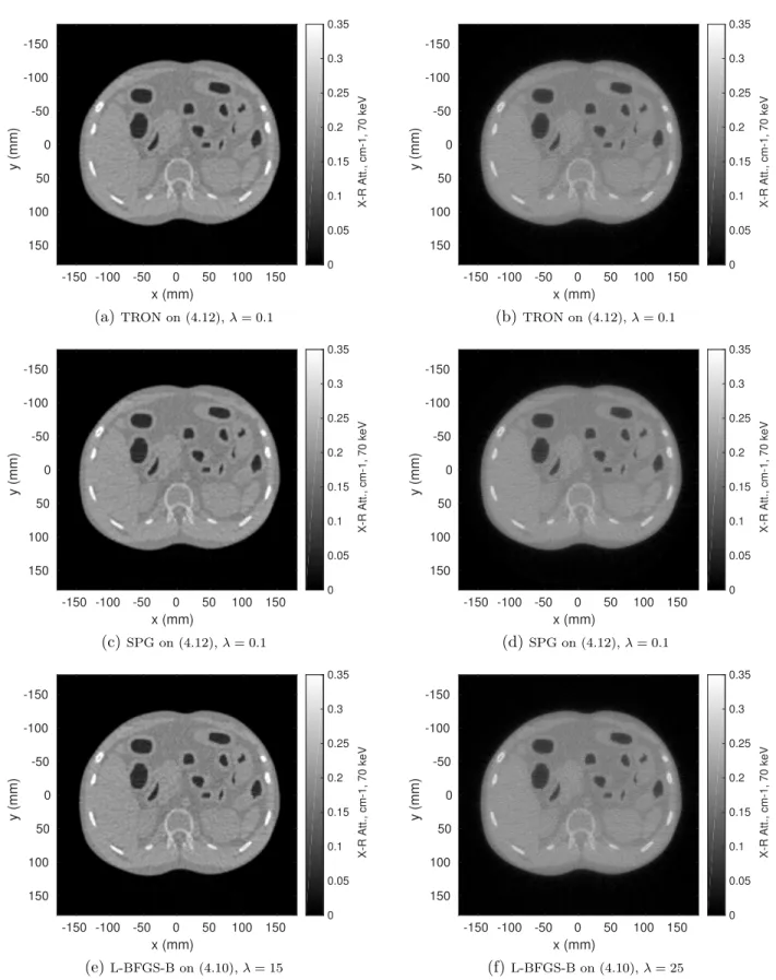 Figure 4.3 Reconstruction results using the L 2 norm on the gradient of the object (left) and the L 2 norm on the object (right)
