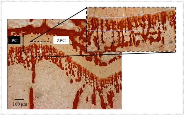 Figure 1.6: Minéralisation montrant la plaque de croissance (PC) et la zone de calcification  provisionnelle (ZPC) (Tsai, et al