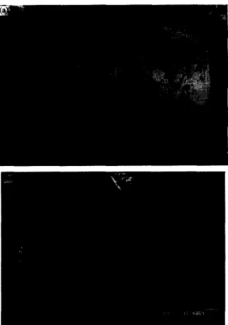 Fig.  7.  Surface  and  oriented  crystal  faces:  (a)  the  faces  most  developed  are  visible  (AT<  35  “C,  experiment  4);  (b)  the  developed  faces  are  oblique  (AT>35”C,experiment  13)