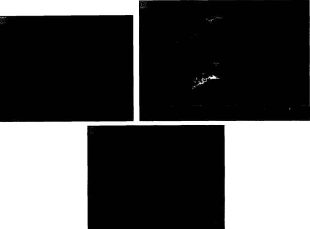 Fig.  6.  Coalescence  and  agglomeration  during  the  process:  (a)  coalescence  of  droplets  leading  to  a  deformed  grain  (AT=  9.4  “C,  experiment  IO);  (b)  agglomeration  of  grains  (966  ppm  mowiol,  experiment  19);  (c)  deformed  grain 