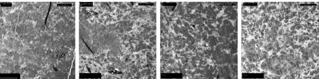 Figure 2-20. TEM micrographs of samples taken at L/D= 8, 9, 10 and 15 upon dynamic  vulcanization of PE/EPDM blend (50/50; w/w) (M