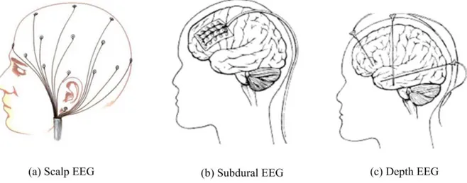 Figure 1.1: Different placement of electrodes  for recording  EEG signals. Image obtained  from  [4]