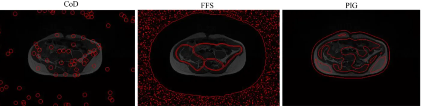 Figure  2.16 : Three different automatic initialization methods on a MR image; center of  divergence (CoD) method (left), force field segmentation (FFS) method (middle), and Poisson 