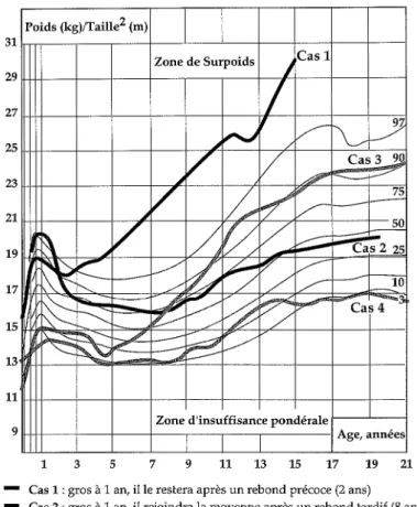 Figure 1.2 : Représentation graphique de 4 types d'évolution de la corpulence de la naissance à l'âge adulte (d'après Rolland-Cachera et coll., 1987)