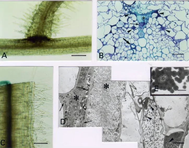 Fig. 4. Microscopy of tomato root infection and vascular colonization phenotypes of the Ralstonia solanacearum hrpB mutant strain GMI1541