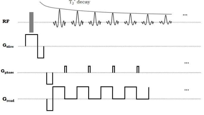 Figure 2-11: Gradient echo EPI acquisition. 