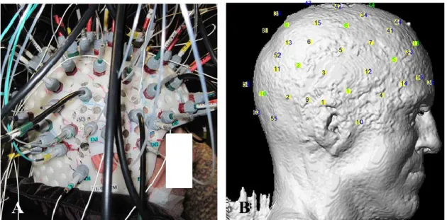 Figure 3.1: (A) Example of helmet configuration in one simultaneous EEG-fNIRS recording on an  epileptic patient (B) Co-registered optode distribution projected onto the scalp: sources/detectors  are marked in blue/green respectively