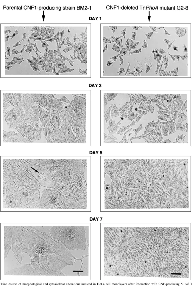 FIG. 1. Time course of morphological and cytoskeletal alterations induced in HeLa cell monolayers after interaction with CNF-producing E