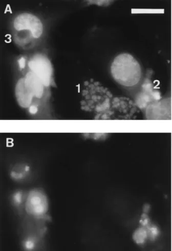 FIG. 4. Nuclear alterations displayed by HeLa cell monolayers on day 5 after a 4-h interaction (on day 1) with cultures of G2-8 (A) and BM2-1 (B) and with sterile sonicated extracts of BM2-1 interaction cultures (C)