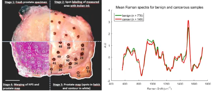 Figure 2.5 (left) Methodology for spatial correlation of Raman spectroscopy measurements and  tissue for diagnosis
