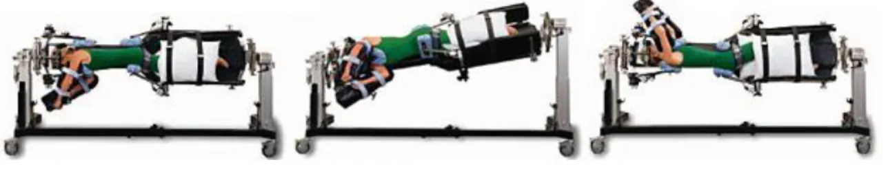Figure 14: Rotation de 180 o  d’un patient  sur le Jackson Spinal System 