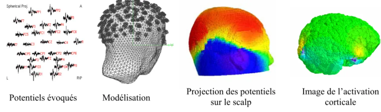 Figure I.2.1 : exemple de reconstruction d’une image de l’activation cérébrale par EEG  [Franceries et al