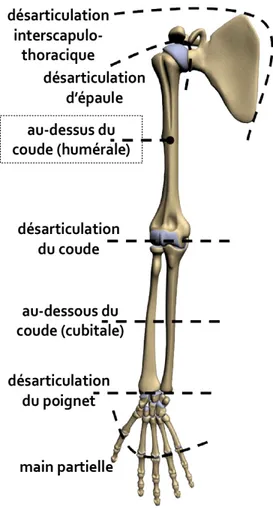Figure 2-5 : Niveau d'amputation du membre supérieur, adapté de (Cordela, 2016) 