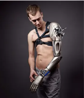 Figure 2-13 : Phantom Limb bionic hand réalisé par OpenBionic, tiré de 