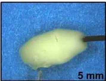 Figure  2.5 Lesion obtained with RF probe (Jean Raymond et al., 2010)  2.7 Summary and Conclusions 