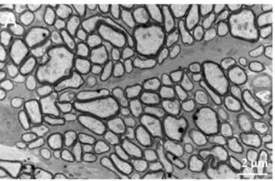 Figure 2-11 : Image MET d’axones de nerfs optiques de souris, échelle 2 μm [70].    Microscope électronique à balayage (MEB) 