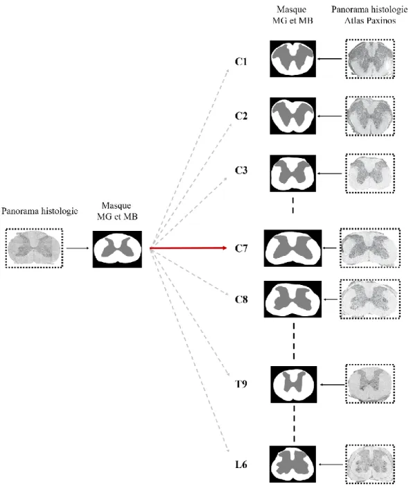 Figure 3-6 : Identification des niveaux vertébraux des échantillons acquis au MEB. 
