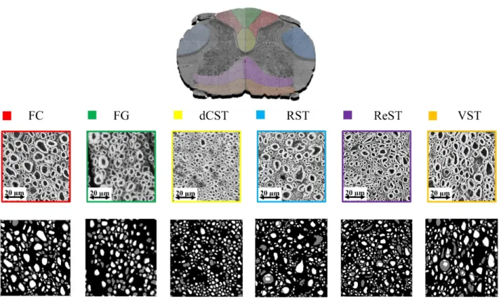 Figure 4-2 : Validation de la segmentation automatique par AxonSeg.  Les résultats de la segmentation sont données dans le Tableau 4-1