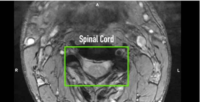 Figure 2.5 A random axial slice from a random selected subject of the Spinal Cord Gray Matter Segmentation Challenge [2]