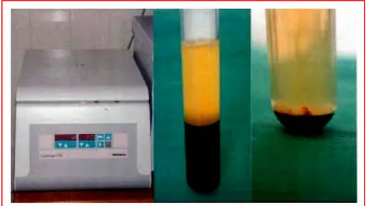 Figure 17: Kit PRP Friadent-Schütze (centrifugeuse, vacutainer après première et 