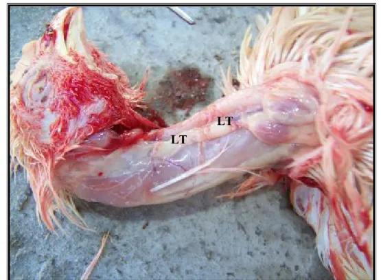 Figure 6 : Les lobes thymiques (LT) en sa position normale. LT