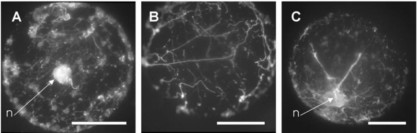 Fig. 4: Effect of RGD peptides on actin organization in 1-day-old protoplasts. Protoplasts  incubated with the GRGDSP hexapeptide, showing (A) a disrupted cortical actin network, (B)  and (C) broken actin wires