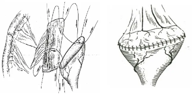 Figure N° VII-1: un segment  d’iléon est isolé avec sa vascularisation.