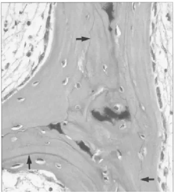 Figure 8: lignes cimentaires, flèches verticales : lignes de quiescence, flèches horizontales : ligne de revirement  (Thompson, 2007).