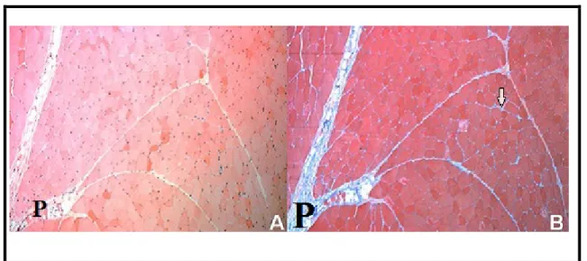 Figure 08 :  coupes histologiques du muscle droit de l'abdomen colorées avec (A):H&amp;E; (B) :  Trichrome de Masson  (Calvi et al., 2012)