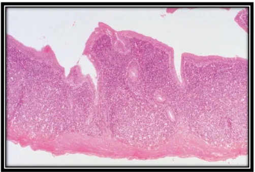 Figure 3 : Caecum (oiseau). H&amp;E. x 12,5(Aughey et Frye, 2001). 