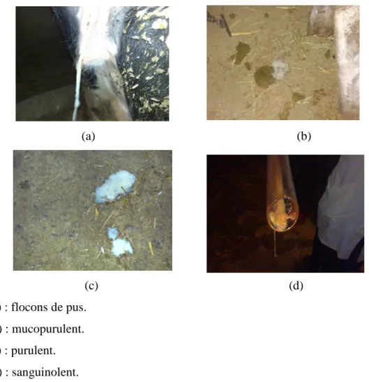 Fig. n°18: La nature du jetage (les écoulements vulvaires) et sa classification selon 