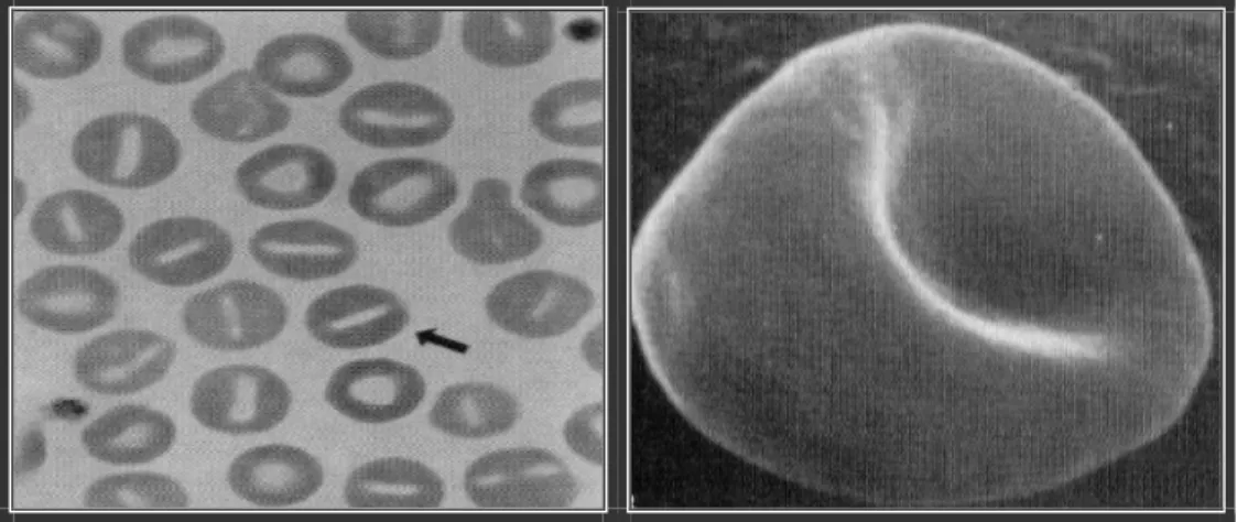 Figure 25 : Les Stomatocytes chez un Chien. (INABA, 2000) IV/ Les inclusions érythrocytaires :