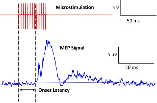 Figure  3-2:  Illustration  of  performance  measurements  of  the  MEP  signal.  Onset  latency  is  the  delay  between  the  onset  of  stimulation  and  the  initiation  of  the  MEP