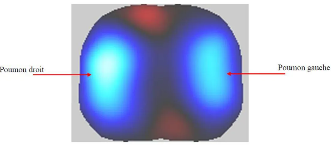 Figure 2.4 : Exemple d’une image de variation de conductivité obtenue par TIE sur un volontaire  au niveau du cinquième espace intercostal, le noir représente un changement nul de conductivité, 