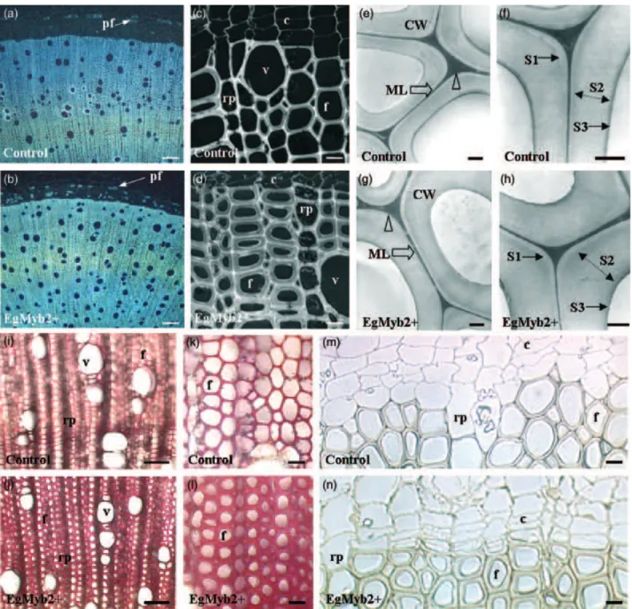 Figure 8. Cytological effects of EgMYB2 over-expression in stem sections.