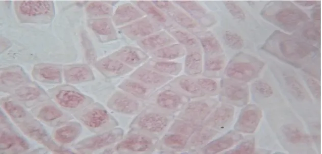 Figure 23: Différentes phases mitotiques de Prospero autumnalis observées au microscope 