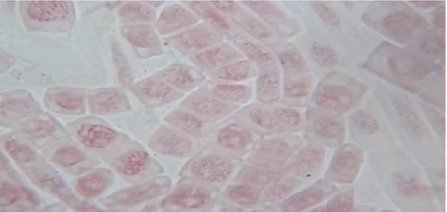 Figure 23: Différentes phases mitotiques de Prospero autumnalis observées au microscope 